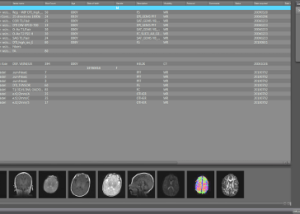 software - MedINRIA 2.2.3 screenshot