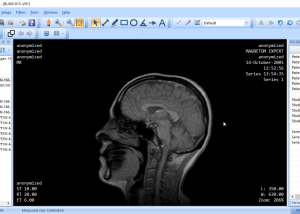 software - MicroDicom 2024.2 screenshot