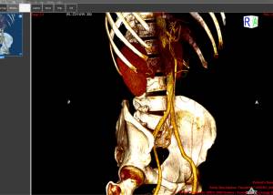 software - ORPALIS DICOM Viewer Free 1.1.2 screenshot