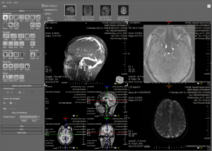 software - ORS Visual Lite 1.5.1 screenshot